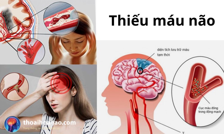 2.1. Dựa vào triệu chứng 1