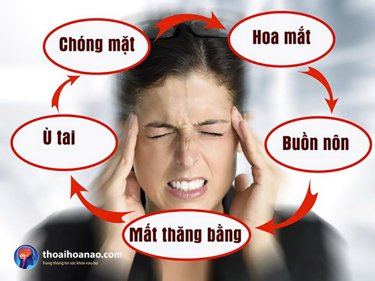 Rối loạn tiền đình 1 Rối loạn tiền đình 1