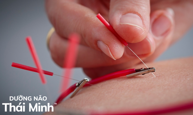 3.2. Cách điều trị thiếu máu não bằng bấm huyệt 1